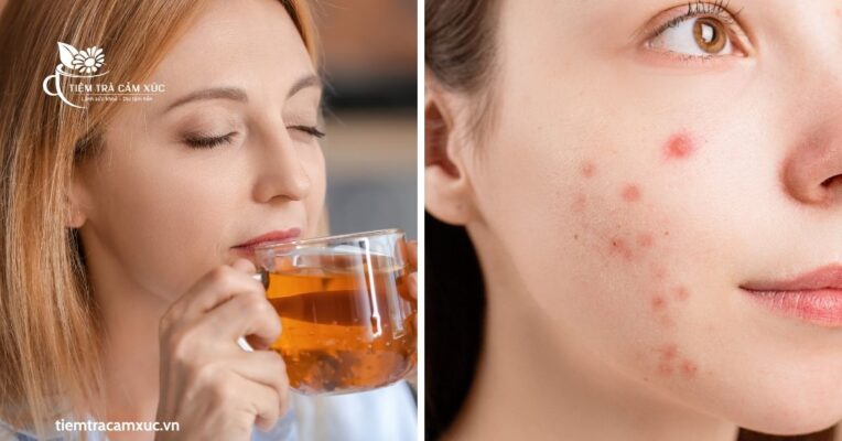 Trà nóng gây nổi mụn 